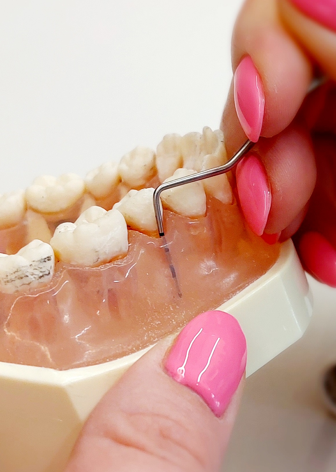 Periodontologia w pracy higienistki stomatologicznej
