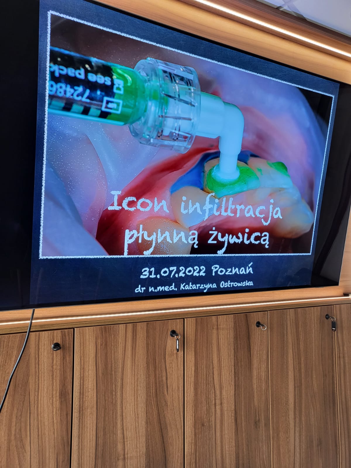 ICON - infiltracja płynną żywicą - obrazek 5